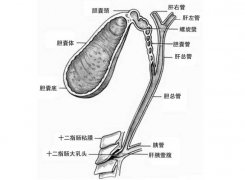 胆结石不能吃什么食物(胆结石吃什么可以化掉)